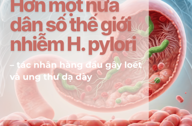 Hơn một nửa dân số thế giới nhiễm H. pylori – tác nhân hàng đầu gây loét và ung thư dạ dày
