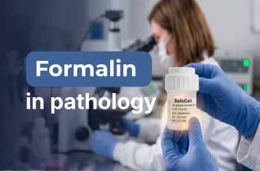 Formalin trong bảo quản mẫu sinh thiết: Vì sao ảnh hưởng trực tiếp đến chất lượng chẩn đoán?